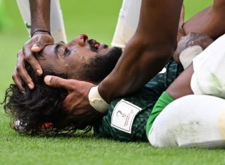 مدافع مصدوم عربستان به تمرین الهلال بازگشت